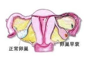 患上卵巢囊肿之后有什么症状