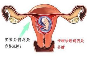 成都女性关于子宫病变与习惯性流产